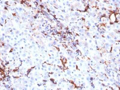Immunohistochemistry-Paraffin: Cathepsin K Antibody (CTSK/2791) - Azide and BSA Free [NBP2-79889]