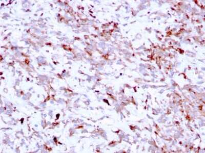 Immunohistochemistry-Paraffin: Cathepsin K Antibody (CTSK/2791) [NBP2-79754]