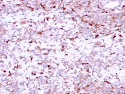 Immunohistochemistry-Paraffin: Cathepsin K Antibody (CTSK/2791) [NBP2-79754]