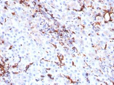 Immunohistochemistry-Paraffin: Cathepsin K Antibody (CTSK/2791) [NBP2-79754]