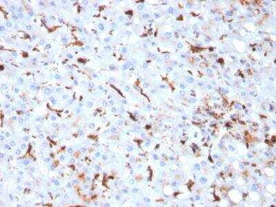 Immunohistochemistry-Paraffin: Cathepsin K Antibody (CTSK/2793) - Azide and BSA Free [NBP2-79900]