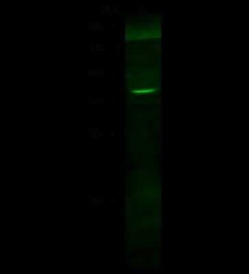 Western Blot: Cathepsin K Antibody [NBP2-99073]