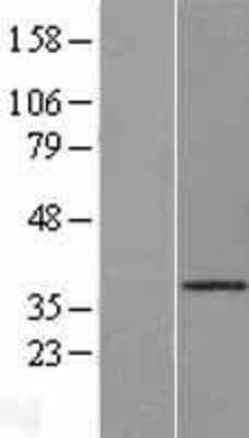 Western Blot: Cathepsin O Overexpression Lysate [NBL1-09597]