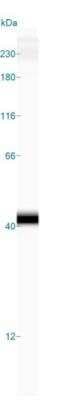 Simple Western: Cathepsin X/Z/P Antibody [NBP2-38614]