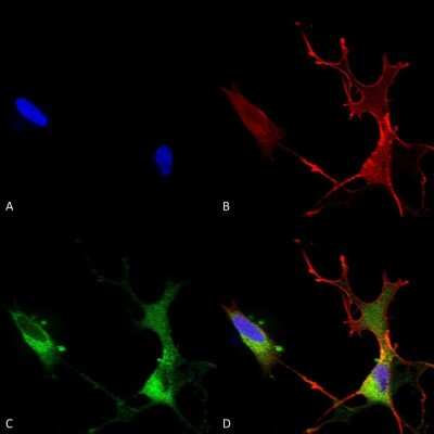 Immunocytochemistry/ Immunofluorescence: Cav1.2 Antibody (S57) [NBP1-22439]
