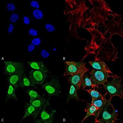 Immunocytochemistry/ Immunofluorescence: Cav1.2 Antibody (S57) [NBP1-22439]