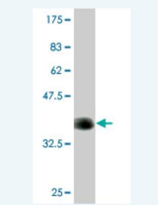 Western Blot: Cav1.4 Antibody (1H6) [H00000778-M05]