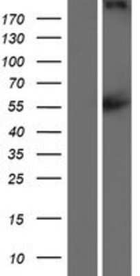 Western Blot: Cav1.4 Overexpression Lysate [NBP2-10486]