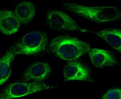 Immunocytochemistry/ Immunofluorescence: Cav1.2 Antibody [NBP2-76914]