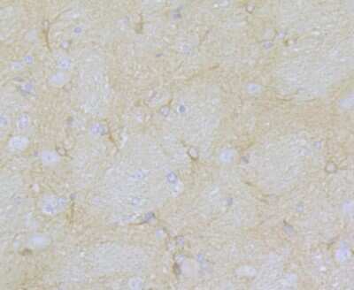 Immunohistochemistry-Paraffin: Cav1.2 Antibody [NBP2-76914]