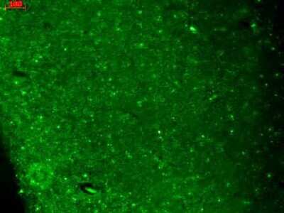 Immunohistochemistry-Paraffin: Cav3.2 Antibody (S55/10) [NBP1-22444]