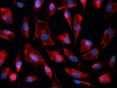 Immunocytochemistry/ Immunofluorescence: Caveolin-1 Antibody (7C8) - Azide and BSA Free [NBP2-80617]