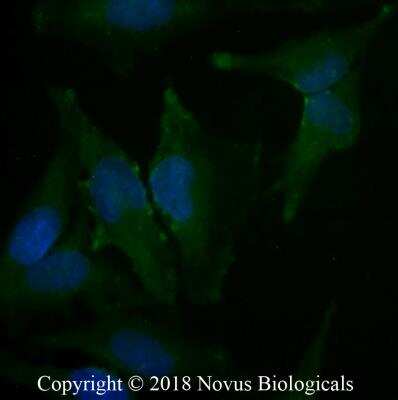 Immunocytochemistry/ Immunofluorescence: Caveolin-1 Antibody (7C8) [NB100-615]