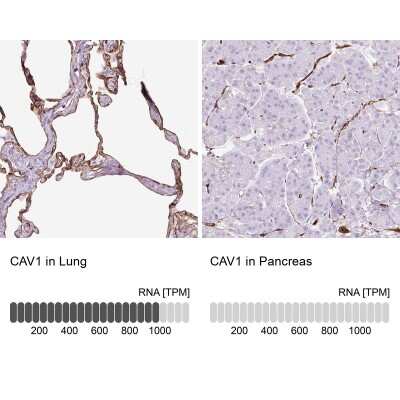Immunohistochemistry-Paraffin: Caveolin-1 Antibody [NBP2-54737]