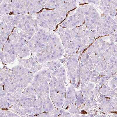 Immunohistochemistry-Paraffin: Caveolin-1 Antibody [NBP2-54737]