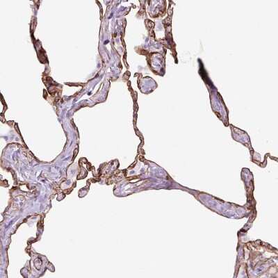 Immunohistochemistry-Paraffin: Caveolin-1 Antibody [NBP2-54737]