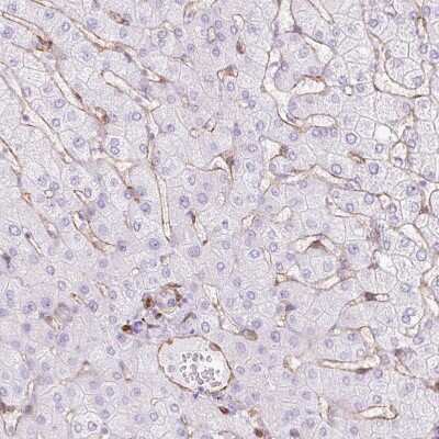Immunohistochemistry-Paraffin: Caveolin-1 Antibody [NBP2-54737]