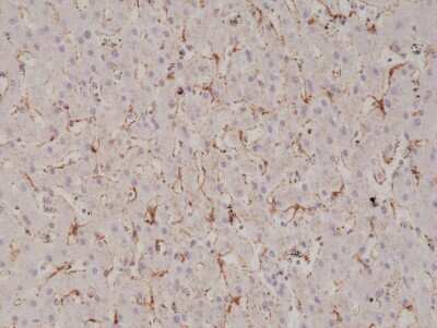 Immunohistochemistry-Paraffin: Caveolin-1 Antibody (RM325) [NBP2-77410]