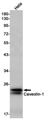Western Blot: Caveolin-1 Antibody (S01-9C9) [NBP3-20077]