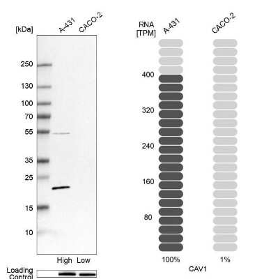Western Blot: Caveolin-1 Antibody [NBP2-54737]