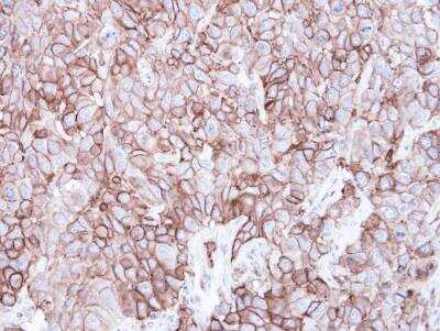 Immunohistochemistry-Paraffin: Caveolin-2 Antibody [NBP1-31116]