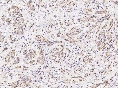 Immunohistochemistry-Paraffin: Caveolin-2 Antibody [NBP2-98731]