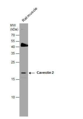 Western Blot: Caveolin-2 Antibody [NBP1-31116]