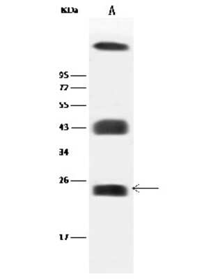 Western Blot: Caveolin-2 Antibody [NBP2-99542]