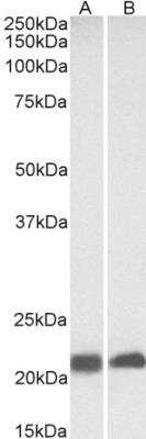Western Blot: Caveolin-3 Antibody [NBP1-28917]