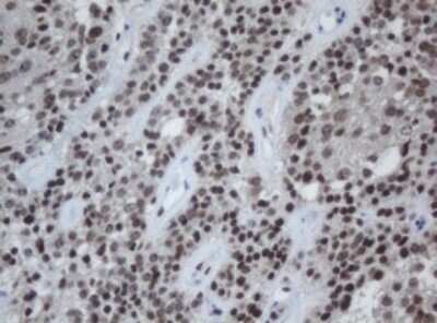 Immunohistochemistry: Cbx8 Antibody (OTI3D1) [NBP2-46073]
