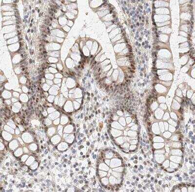 Immunohistochemistry-Paraffin: Cbx8 Antibody [NBP1-83224]