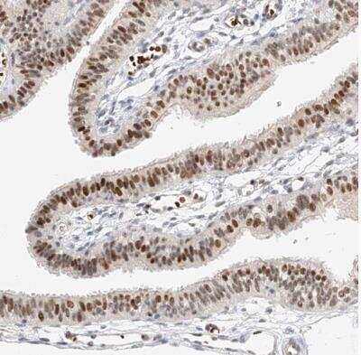 Immunohistochemistry-Paraffin: Cbx8 Antibody [NBP1-83224]