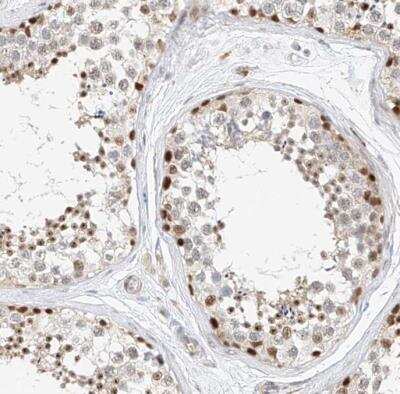 Immunohistochemistry-Paraffin: Cbx8 Antibody [NBP1-83224]