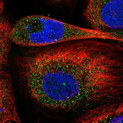Immunocytochemistry/ Immunofluorescence: Ccd1/DIXDC1 Antibody [NBP2-58141]
