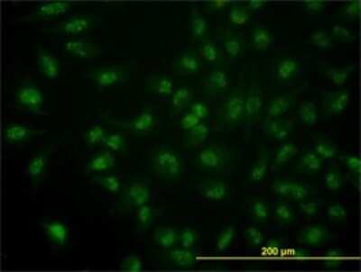 Immunocytochemistry/ Immunofluorescence: Cdc14A Antibody (1F11) [H00008556-M02]