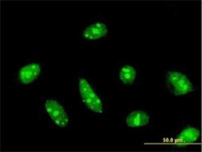 Immunocytochemistry/ Immunofluorescence: Cdc14A Antibody (2C12) [H00008556-M01]