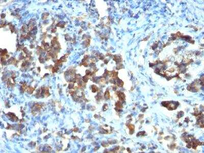 Immunohistochemistry-Paraffin: Cdc20 Antibody (CDC20/1102) - IHC-Prediluted [NBP2-48037]