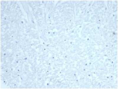 Immunohistochemistry-Paraffin: Cdc20 Antibody (CDC20/7026R) [NBP3-13820]