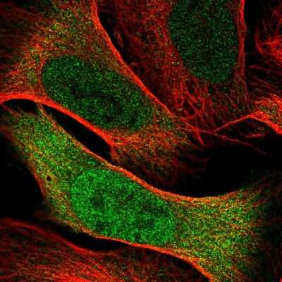 Immunocytochemistry/ Immunofluorescence: Cdc20 Antibody [NBP2-38750]