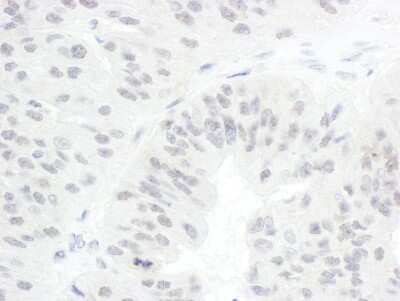Immunohistochemistry-Paraffin: Cdc20 Antibody [NB100-59827]