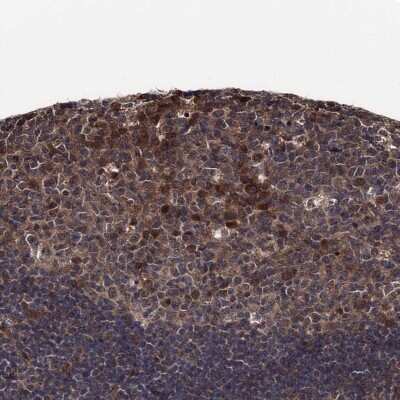 Immunohistochemistry-Paraffin: Cdc23 Antibody [NBP1-89093]