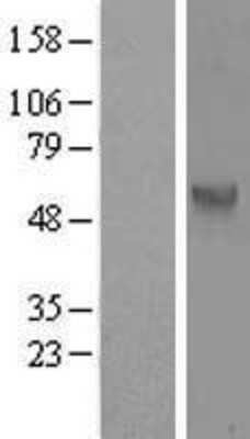 Western Blot: CDC25C Overexpression Lysate [NBL1-08996]