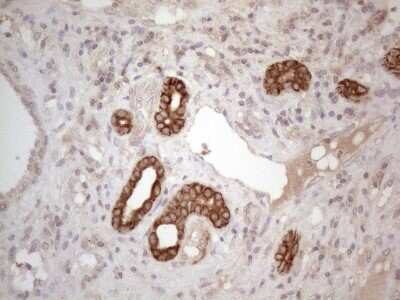 Immunohistochemistry: Cdc6 Antibody (OTI1A4) [NBP2-46192]
