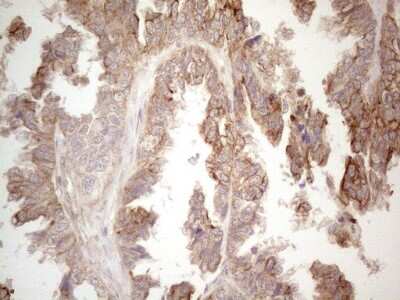 Immunohistochemistry: Cdc6 Antibody (OTI1A4) [NBP2-46192]