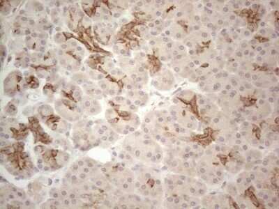 Immunohistochemistry: Cdc6 Antibody (OTI1A4) - Azide and BSA Free [NBP2-70383]