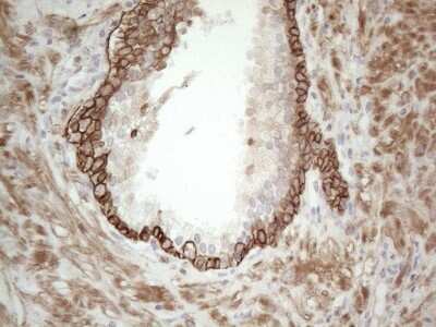 Immunohistochemistry: Cdc6 Antibody (OTI1A4) - Azide and BSA Free [NBP2-70383]