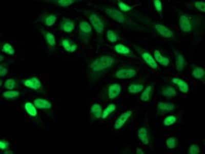 Immunocytochemistry/ Immunofluorescence: CDK2 Antibody (OTI2D9) [NBP2-00776]
