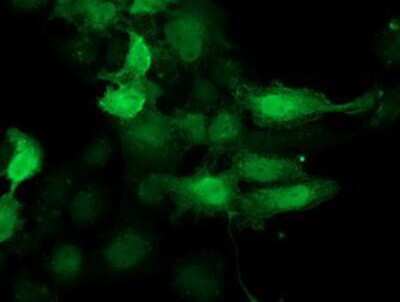 Immunocytochemistry/ Immunofluorescence: CDK2 Antibody (OTI2D9) [NBP2-00776]