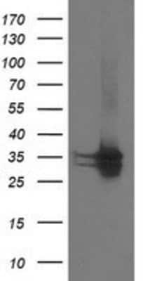 Western Blot: CDK2 Antibody (OTI2D9) [NBP2-00776]
