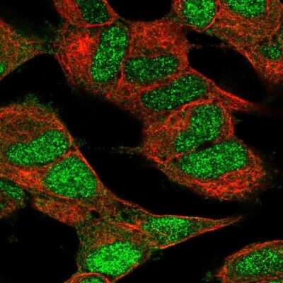 Immunocytochemistry/ Immunofluorescence: Cdk5 Antibody [NBP2-55870]